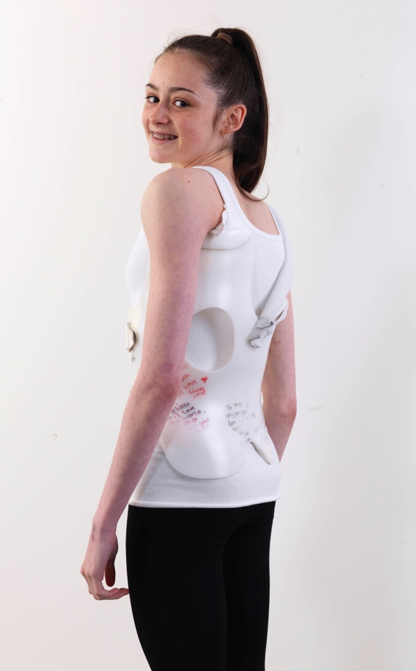 Julia's Scoliosis Clinic Story - Blatchford Ortopedi